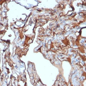 MCAM (Melanoma Cell Adhesion Molecule) / MUC18 / CD146; Clone MUC18/1130 (Concentrate)